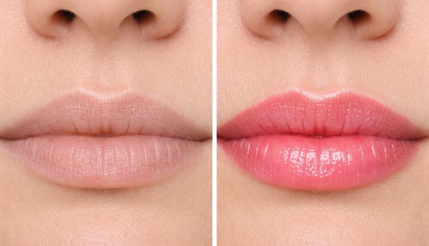 BALSAMO ACIDO HIALAURÓNICO