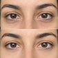Electric Eye Cream with Red Light Massager | Caviar, Hyaluronic Acid & Vitamin E